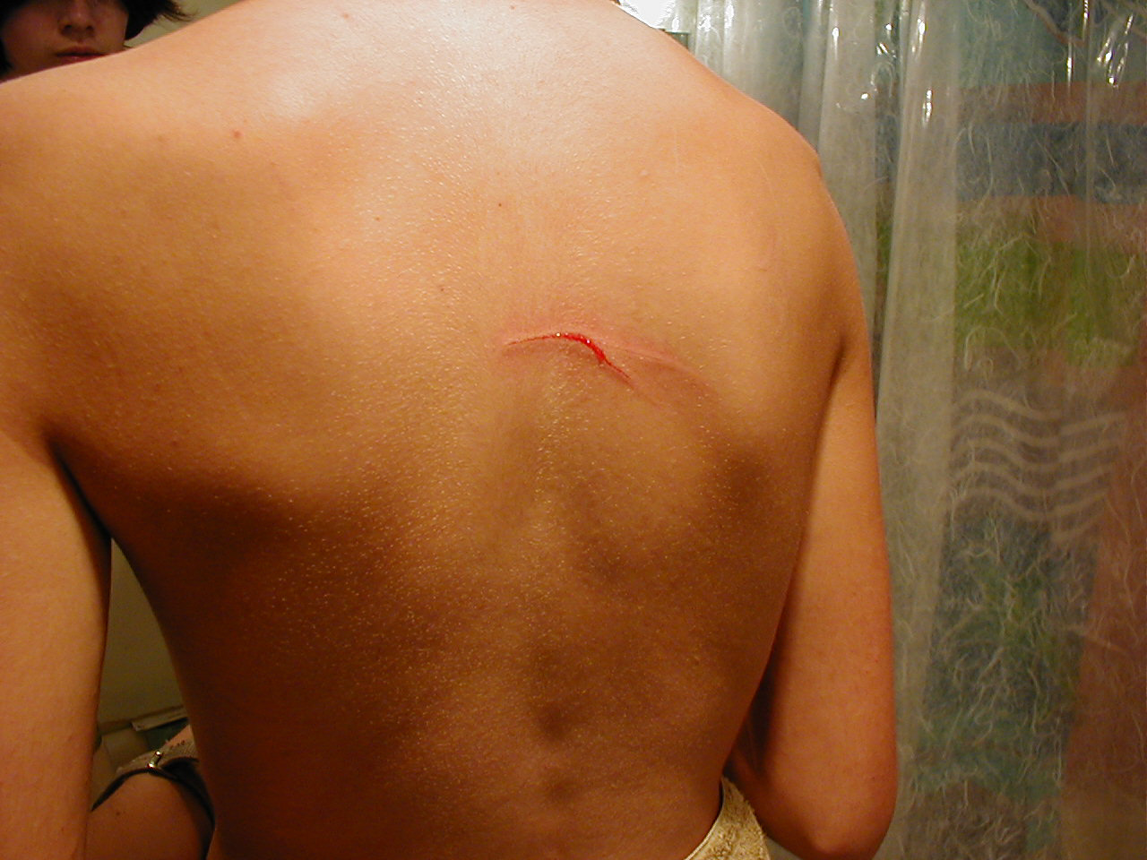 Ouch